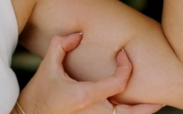 Un simplu cip implantat in brat este suficient pentru ca o persoana obeza sa poata slabi